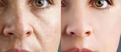 Why does my skin look different in Winter?